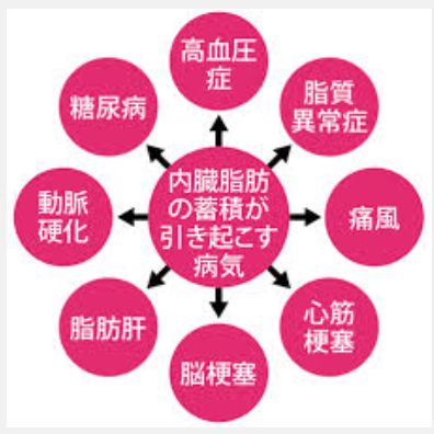 内臓脂肪　病気　画像